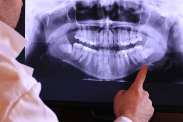 Best Broken Tooth Emergency  in Canton, MS